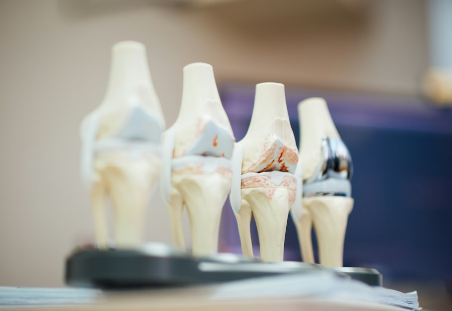 Joint and Bone Health